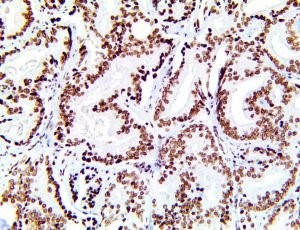 sf1, sf-1, sf 1, anti sf-1, anti-sf-1, anti-sf1, steroidogenic Factor 1, anti-steroidogenic MAIN