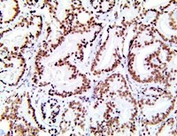 sf1, sf-1, sf 1, anti sf-1, anti-sf-1, anti-sf1, steroidogenic Factor 1, anti-steroidogenic MAIN