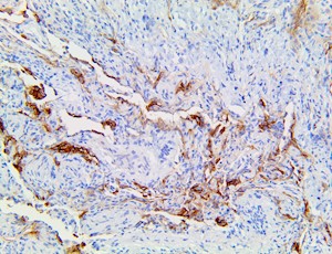 cd142, anti-cd142, tf, anti-tf, coagulation factor iii, coagulation factor 3, anti-tf, anti-coagulation factor, tissue f MAIN