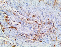 cd142, anti-cd142, tf, anti-tf, coagulation factor iii, coagulation factor 3, anti-tf, anti-coagulation factor, tissue f MAIN