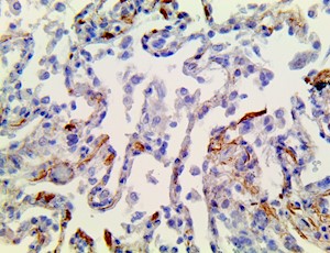 cytokine storm, cytokine storm syndrome, cytokine storm antibody, cytokine storm antibodies, sars-cov-2 receptors, sars MAIN