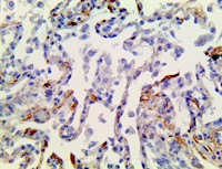 cytokine storm, cytokine storm syndrome, cytokine storm antibody, cytokine storm antibodies, sars-cov-2 receptors, sars MAIN