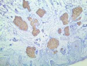 TintoFast Adipophilin (BSB-91), MMab MAIN