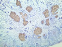 TintoFast Adipophilin (BSB-91), MMab MAIN