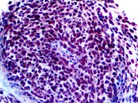 tle1 tle-1 tle 1, TLE1, anti-TLE1, anti TLE1, Enhancer of split groucho-like protein 1 (ESG1), anti-Enhancer of split gr MAIN
