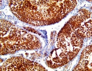 tigit, anti-tigit, T cell immunoreceptor with Ig and ITIM domains MAIN