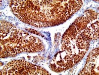 tigit, anti-tigit, T cell immunoreceptor with Ig and ITIM domains MAIN