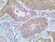 gab1, anti-gab1, grb2, anti-grb2, hrb2-associated-binding protein 1 THUMBNAIL