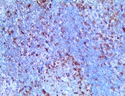 icos, into-icos, cd278. anti-cd278, t-cell costimulatory molecule THUMBNAIL