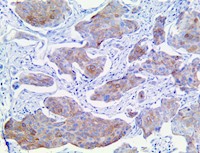 fgfr-3, fgfr 3, fgfr3, anti-fgfr-3, anti-fgfr 3, anti-fgfr3, fibroblast growth actor receptor 3, anti- fibroblast growth MAIN