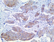 fgfr-3, fgfr 3, fgfr3, anti-fgfr-3, anti-fgfr 3, anti-fgfr3, fibroblast growth actor receptor 3, anti- fibroblast growth THUMBNAIL