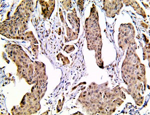 yap1, yap-1, Yes-Associated Protein 1, anti-yap1, anti-yap-1 MAIN