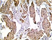 yap1, yap-1, Yes-Associated Protein 1, anti-yap1, anti-yap-1 THUMBNAIL
