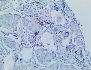 cd137, anti-cd137, tnfrsf9, anti-tnfrsf9, tumor necrosis factor receptor superfamily member 9 MAIN