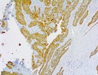 PolyDetector HRP Yellow MAIN