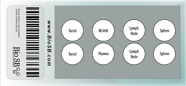 7 Core Normal Human Lymphoid Tissue Microarray MAIN