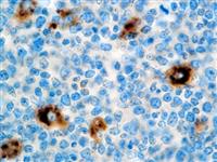 A-1-Antitrypsin (Polyclonal), RPab MAIN