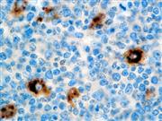 A-1-Antitrypsin (Polyclonal), RPab THUMBNAIL