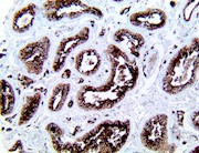 ace2 ace-2 anti-ace2 anti-ace-2 antibody immunohistochemistry ihc THUMBNAIL