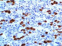 acth anti-acth Adrenocorticotropic Hormone corticotropin anti-corticotropin anti-adrenocarticotropic antibody immunohist MAIN