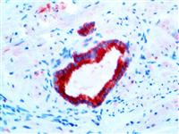 AMACRacemase / P504S (13H4), RMab MAIN