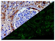 Amyloid A (EP335), RMab THUMBNAIL