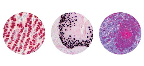 AP Chromogens