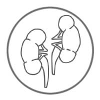 ZytoLight Probes - Renal Cell Carcinoma