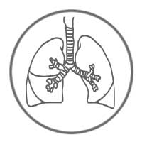 ZytoDot Probes - Lung Cancer