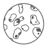 ZytoFast Probes- Lymphoma, other