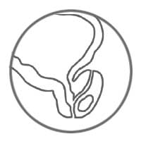 ZytoLight Probes - Prostate Cancer