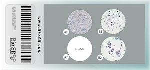 3-core Androgen Receptor Cell Line Microarray, 5 slides MAIN