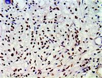 ATRX (BSB-108), MMab MAIN