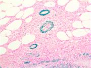 actin muscle specific muscle-specific anti-actin antibody immunohistochemistry ihc THUMBNAIL