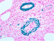 actin-anti-actin smooth muscle smooth-muscle antibody immunohistochemistry ihc THUMBNAIL
