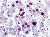 adenovirus anti-adenovirus anti-antibody adenoviridae immunohistochemistry ihc MAIN