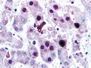 Adenovirus (20/11 and 2/6), MMab THUMBNAIL