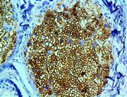 adiposphilin anti-adipophilin adrp anti-adrp anti- antibody immunohistochemistry ihc THUMBNAIL