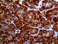 ALDH1A, anti-ALDH1A, ALDH1A antibody, ALDH1A ihc antibody MAIN