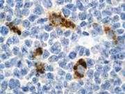 Alpha-1-Antichymotrypsin (Polyclonal), RPab THUMBNAIL