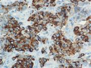 Alpha-Fetoprotein (EP209), RMab THUMBNAIL