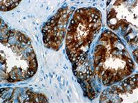 Alpha-Fetoprotein (BSB-23), MMab MAIN