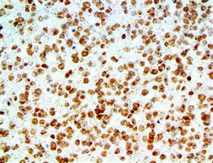 Amyloid Beta (RBT-A4), RMab MAIN