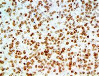 Amyloid Beta (RBT-A4), RMab MAIN