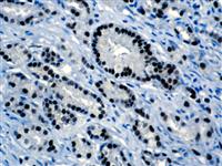 Androgen Receptor (BSB-4), MMab MAIN