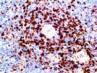 Annexin A1 (BSB-95), MMab MAIN