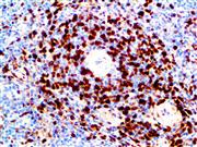 Annexin A1 (BSB-95), MMab THUMBNAIL
