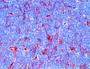B7H3/CD276 (RBT-B7H3), RMab MAIN