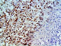 BAP1 (BSB-109), MMab MAIN