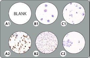 5-Core BRAF V600E Cell Line Microarray MAIN